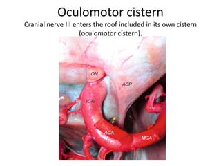 Anterior perforated substance &
olfactory track relation
 