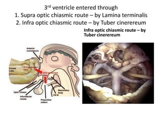 Supratentorial arteries
• http://dc496.4shared.com/doc/2vRIALeU/pre
view.html
 