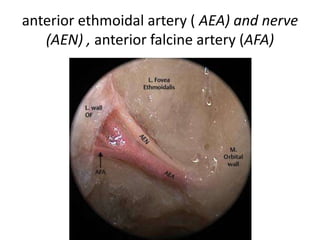 Cavernous Sinus MRI anatomy
 