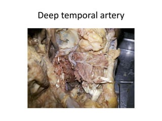 Liliequist membrane [LM]
 