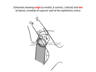 http://www.nature.com/eye/journal/v20/n10/fig_tab/6702377f3.html#figure
-title
The upper diagram is Type a or b Opthalmic artery , the lower diagram is Type
c Opthalmic artery
Dup OC = Duplicate Opthalmic
canal
 