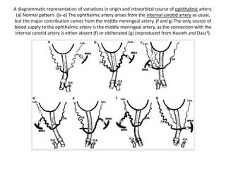 Origin and intracranial and
intracanalicular course of
the ophthalmic artery and its
subdivisions, as seen on opening
the optic canal (reproduced from
Hayreh67).
Both from one specimen. (a) The extradural
origin of the right ophthalmic artery, so that
no ophthalmic artery is seen even on
opening theoptic canal; a thinning of the
dural sheath is seen at 'X', indicating the
position of the artery. (b) The ophthalmic
artery is seen after removing the dural
sheath covering it (reproduced from Hayreh
and Dass2).
 