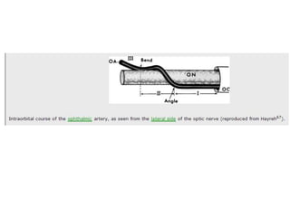 A diagrammatic representation of variations in origin and intraorbital course of ophthalmic artery.
(a) Normal pattern. (b–e) The ophthalmic artery arises from the internal carotid artery as usual,
but the major contribution comes from the middle meningeal artery. (f and g) The only source of
blood supply to the ophthalmic artery is the middle meningeal artery, as the connection with the
internal carotid artery is either absent (f) or obliterated (g) (reproduced from Hayreh and Dass3).
 