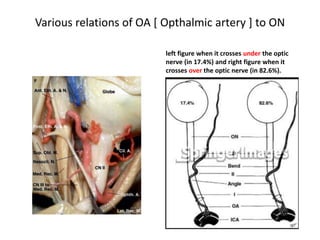 Origin, course, and branches of the ophthalmic artery in two adult specimens. Segment Y
disappeared in (a) and segment Z disappeared in (b), resulting in the ophthalmic artery crossing
under the optic nerve in both. In (b) an anastomosis is seen in lateral wall of the cavernous sinus
between the part of the internal carotid artery lying in proximal part of the cavernous sinus and a
branch from the ophthalmic artery passing through the superior orbital fissure (reproduced from
Hayreh67).
 