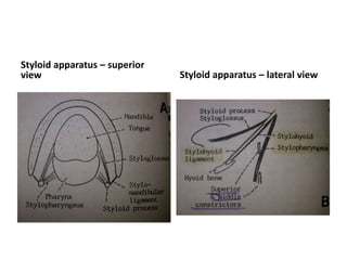 Rerouting of the facial nerve. FN(m) Mastoid
segment of the
facial nerve, FN(p) Intraparotid facial nerve, SM
Facial nerve at the stylomastoid
level, ST Soft tissues
The facial nerve has been rerouted into the new
canal (*).
FC Fallopian canal, FN(p) Rerouted part of the
intratemporal facial nerve,
FN(t) Rerouted part of the tympanic segment of
the facial nerve, ST Soft
tissues
 