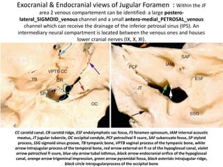 The Petro-occipital Fissure- contains IPS
 