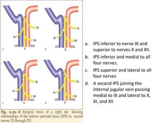 Usually inferior petrosal sinus
opens into jugular bulb
Sometimes along with jugular
bulb opening , it opens into
internal jugular vein also [ lower
single arrow in below photo ]
 