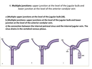 An anatomical classification according to the level of the inferior
petrosal sinus–internal jugular vein junction has been developed
1. Junction at the level of the
jugular bulb
2. Junction at the level of the anterior
condylar vein junction (extracranial
opening of the hypoglossal canal)
 
