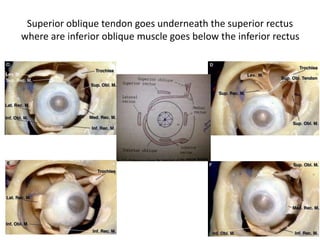 Orbital fascia = Periorbita
 