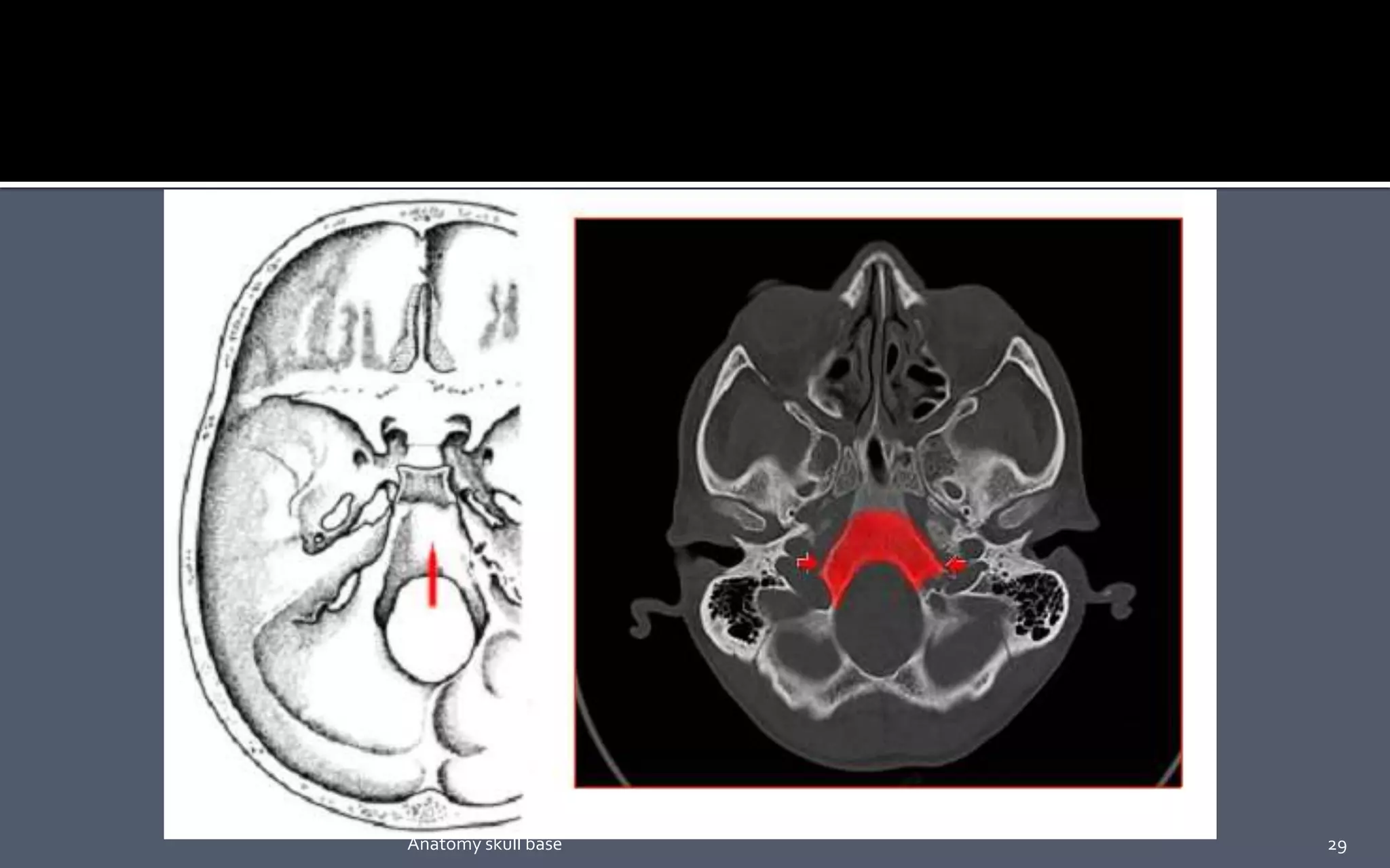 29Anatomy skull base
 