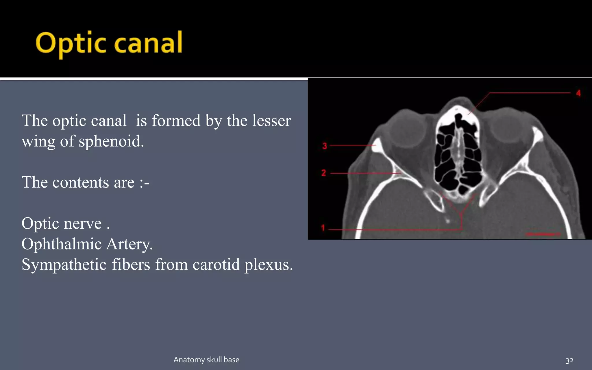 The optic canal is formed by the lesser
wing of sphenoid.
The contents are :-
Optic nerve .
Ophthalmic Artery.
Sympathetic fibers from carotid plexus.
32Anatomy skull base
 