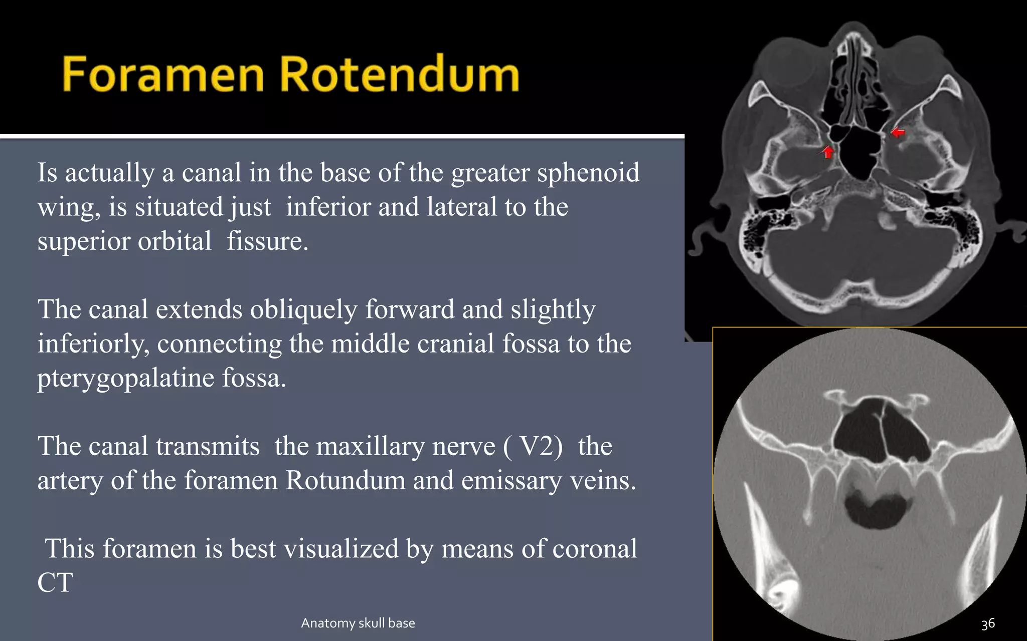 Is actually a canal in the base of the greater sphenoid
wing, is situated just inferior and lateral to the
superior orbital fissure.
The canal extends obliquely forward and slightly
inferiorly, connecting the middle cranial fossa to the
pterygopalatine fossa.
The canal transmits the maxillary nerve ( V2) the
artery of the foramen Rotundum and emissary veins.
This foramen is best visualized by means of coronal
CT
36Anatomy skull base
 