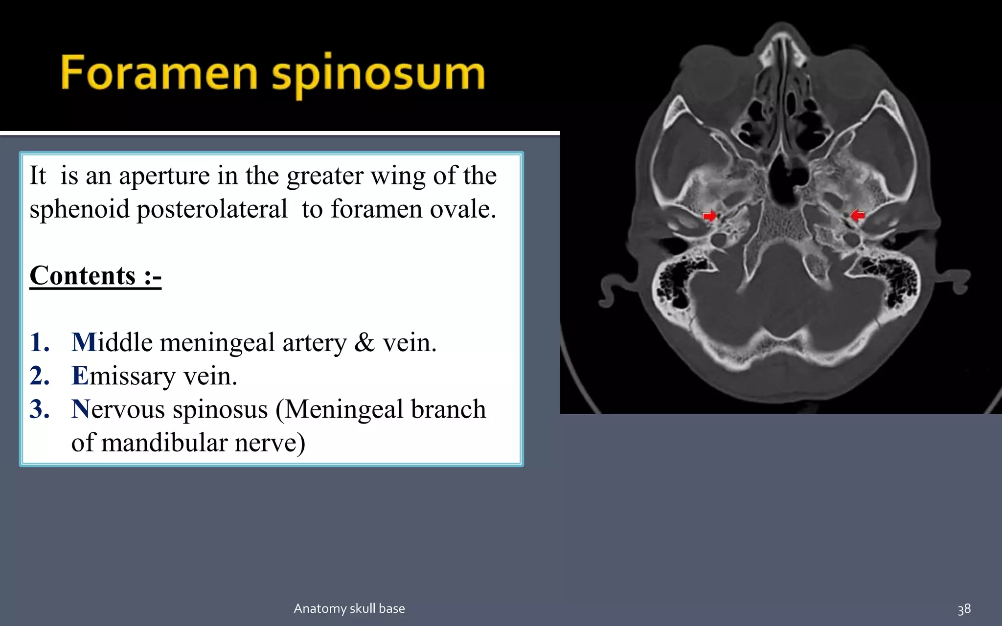 It is an aperture in the greater wing of the
sphenoid posterolateral to foramen ovale.
Contents :-
1. Middle meningeal artery & vein.
2. Emissary vein.
3. Nervous spinosus (Meningeal branch
of mandibular nerve)
38Anatomy skull base
 