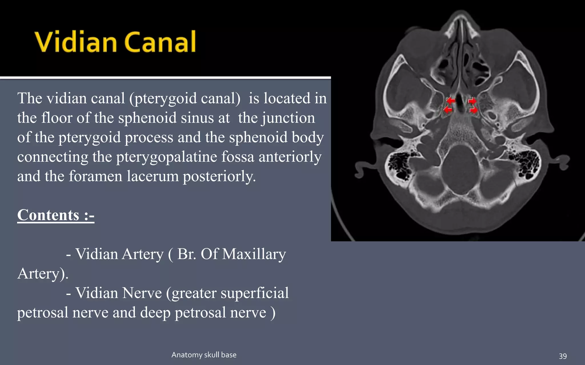 The vidian canal (pterygoid canal) is located in
the floor of the sphenoid sinus at the junction
of the pterygoid process and the sphenoid body
connecting the pterygopalatine fossa anteriorly
and the foramen lacerum posteriorly.
Contents :-
- Vidian Artery ( Br. Of Maxillary
Artery).
- Vidian Nerve (greater superficial
petrosal nerve and deep petrosal nerve )
39Anatomy skull base
 