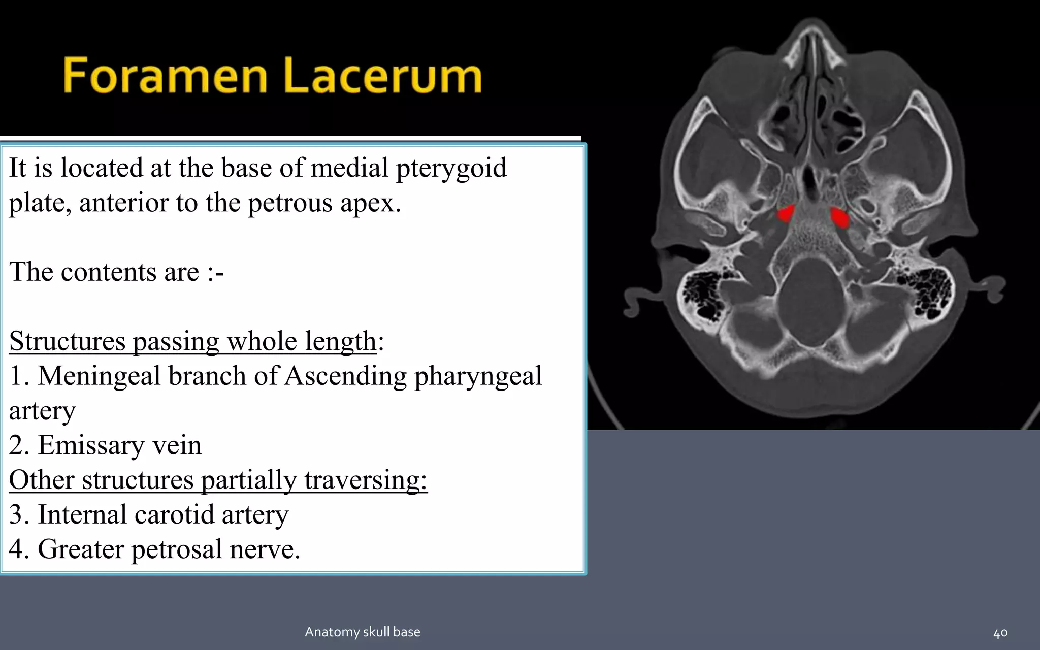 It is located at the base of medial pterygoid
plate, anterior to the petrous apex.
The contents are :-
Structures passing whole length:
1. Meningeal branch of Ascending pharyngeal
artery
2. Emissary vein
Other structures partially traversing:
3. Internal carotid artery
4. Greater petrosal nerve.
40Anatomy skull base
 