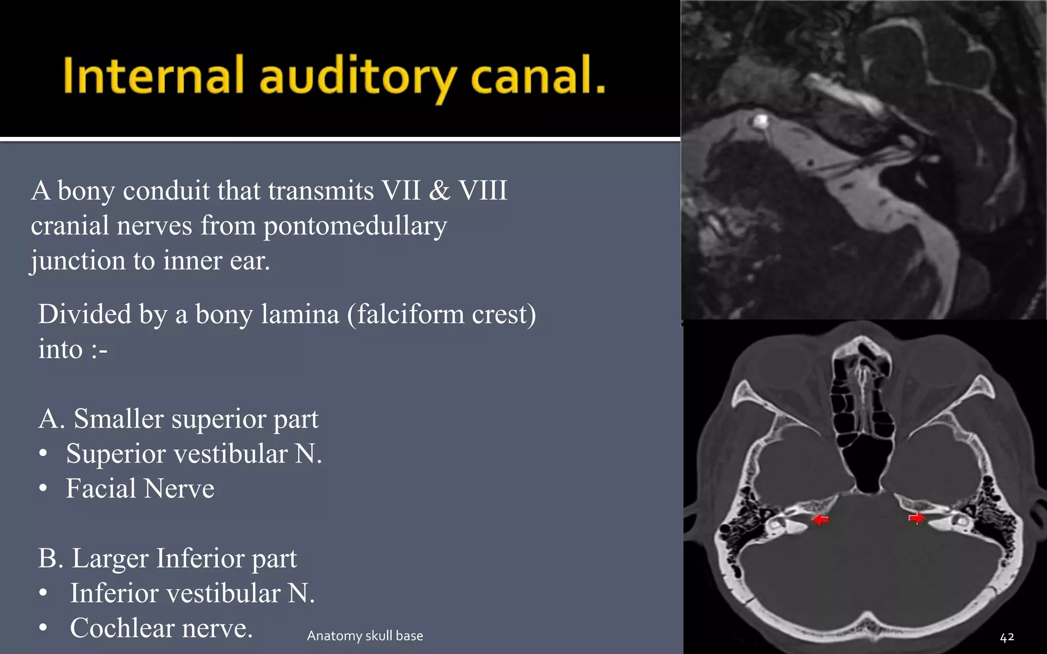A bony conduit that transmits VII & VIII
cranial nerves from pontomedullary
junction to inner ear.
Divided by a bony lamina (falciform crest)
into :-
A. Smaller superior part
• Superior vestibular N.
• Facial Nerve
B. Larger Inferior part
• Inferior vestibular N.
• Cochlear nerve. 42Anatomy skull base
 