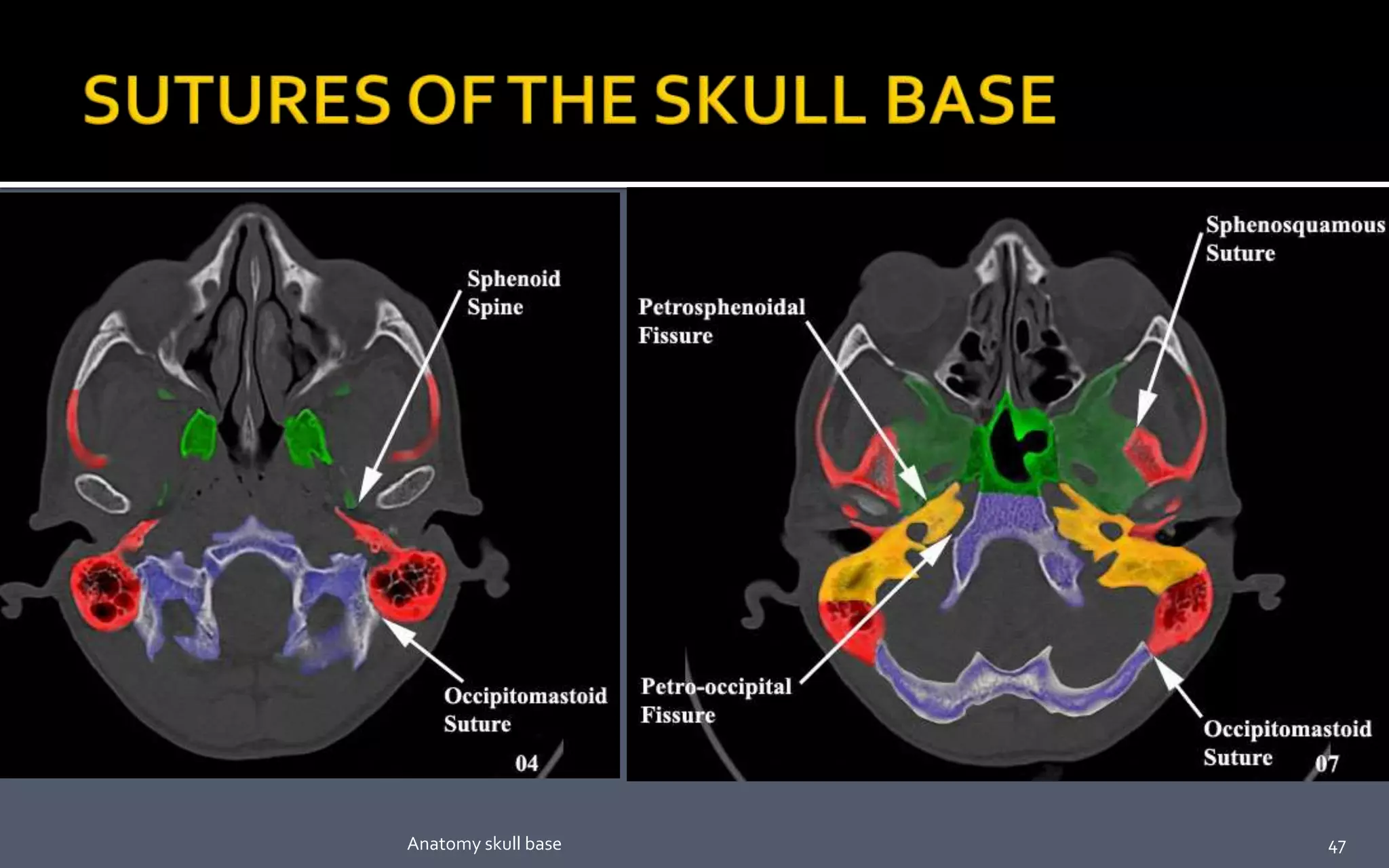 47Anatomy skull base
 