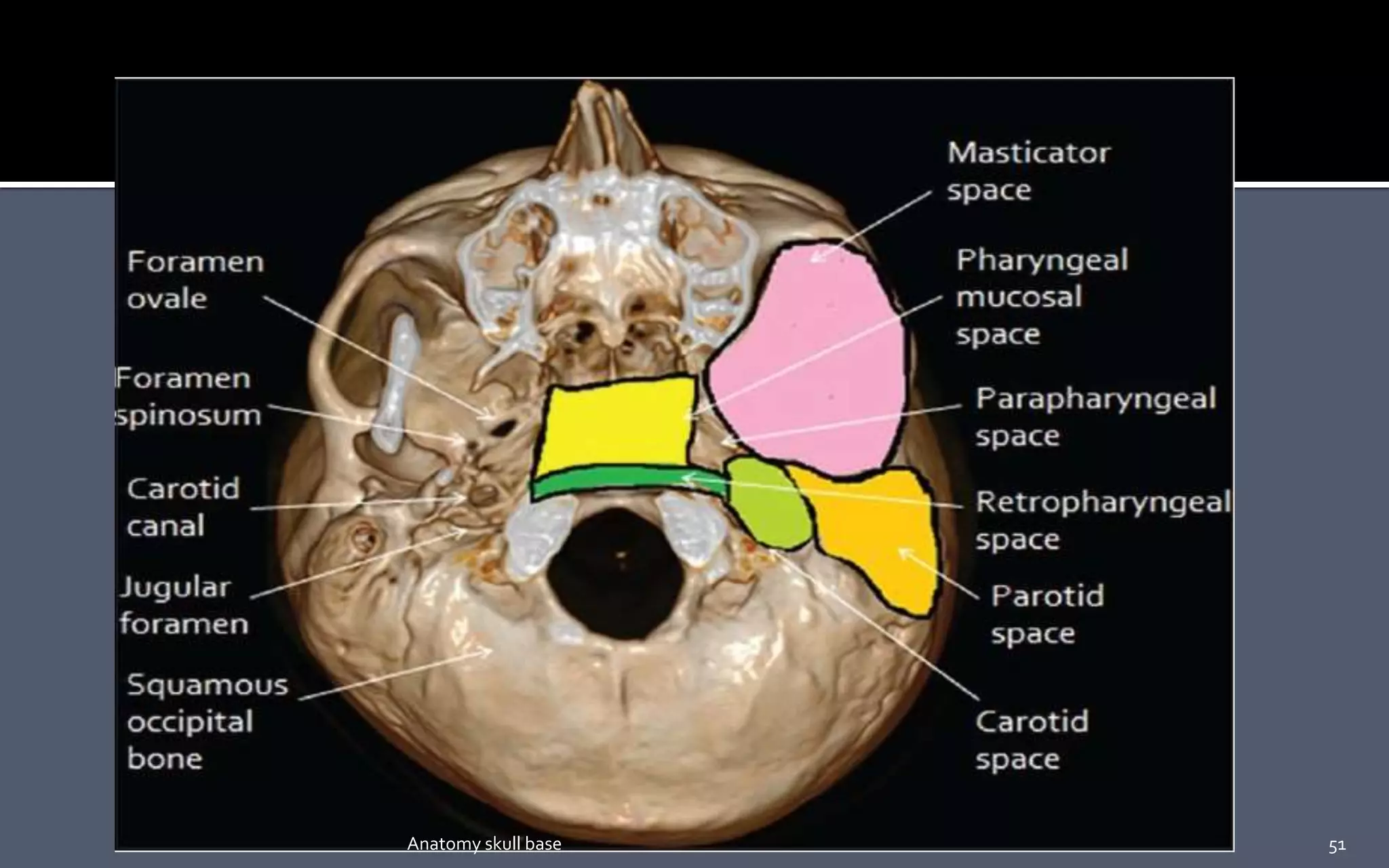 51Anatomy skull base
 