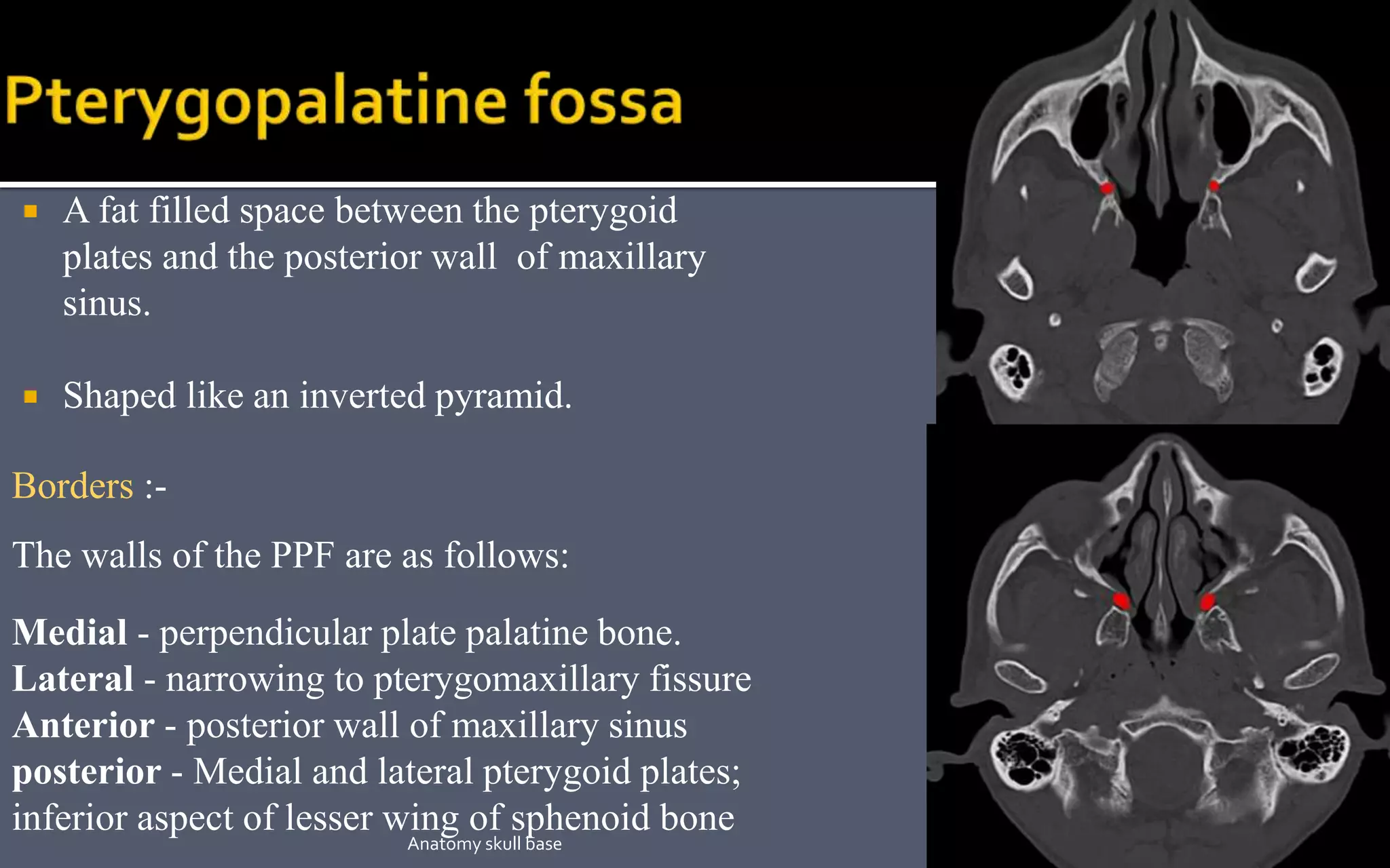  A fat filled space between the pterygoid
plates and the posterior wall of maxillary
sinus.
 Shaped like an inverted pyramid.
Borders :-
The walls of the PPF are as follows:
Medial - perpendicular plate palatine bone.
Lateral - narrowing to pterygomaxillary fissure
Anterior - posterior wall of maxillary sinus
posterior - Medial and lateral pterygoid plates;
inferior aspect of lesser wing of sphenoid bone
52Anatomy skull base
 