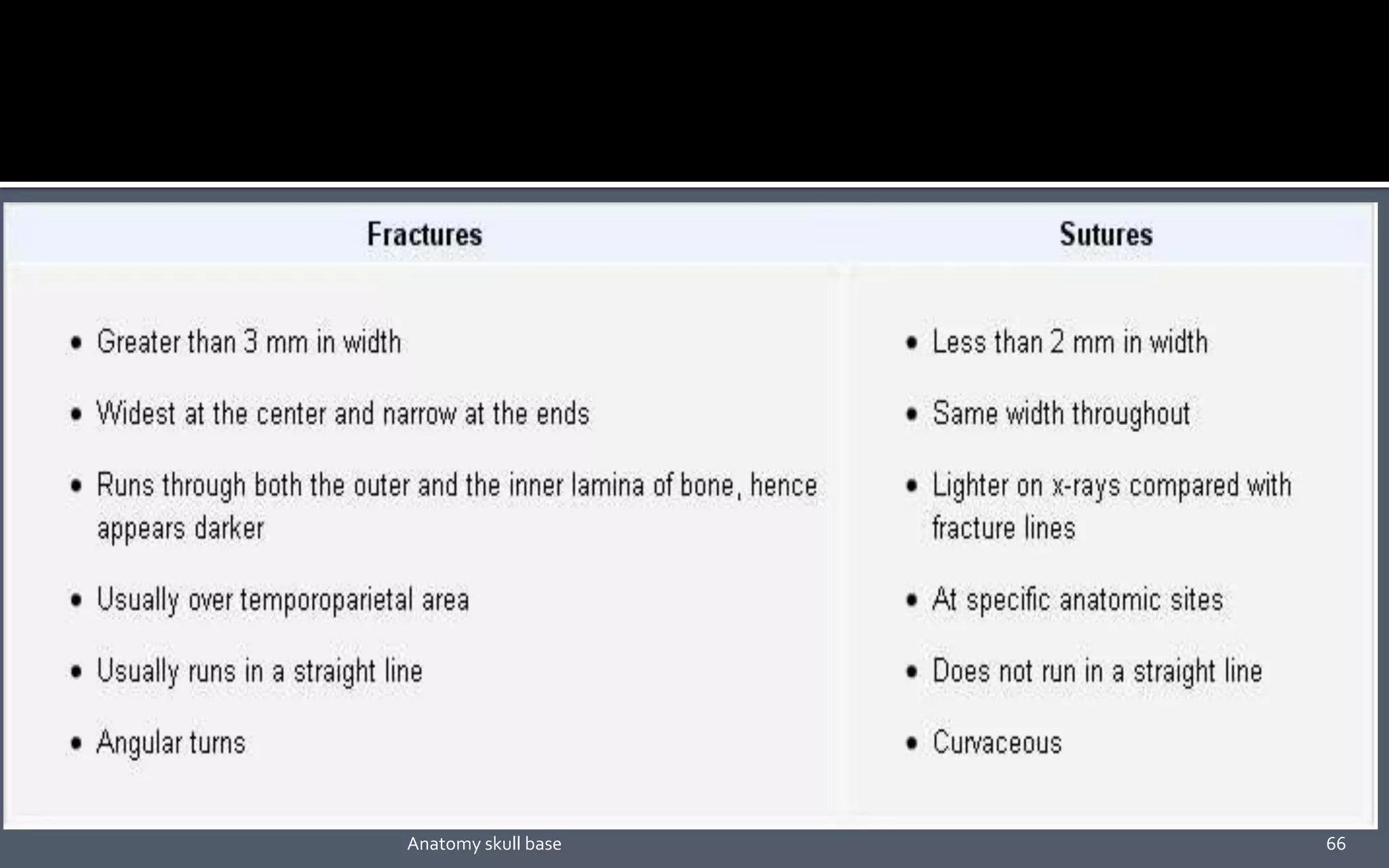 66Anatomy skull base
 