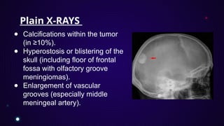 skull-based-meningioma-pptx-for-neurosurgery-pptx