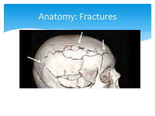 Fractures Base Math Skull Base fractures ( PDFDrive ).pdf