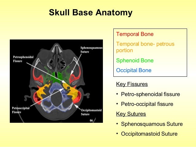 Skull base imaging