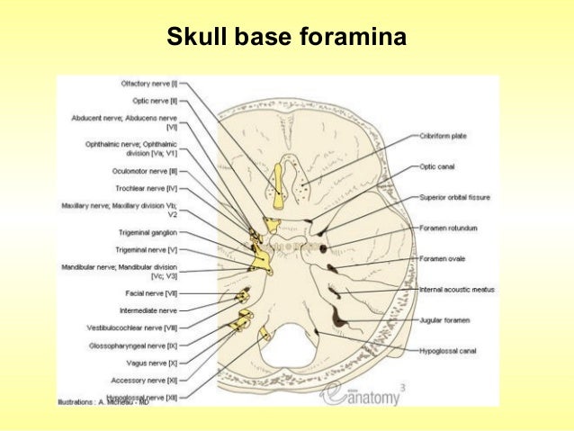 skull base imaging