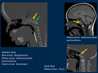 skullbase imaging.pptx