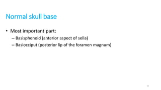 Normal skull base
• Most important part:
– Basisphenoid (anterior aspect of sella)
– Basiocciput (posterior lip of the foramen magnum)
18
 