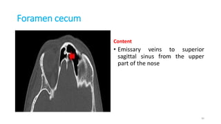 Foramen cecum
Content
• Emissary veins to superior
sagittal sinus from the upper
part of the nose
30
 