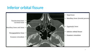 Inferior orbital fissure
Content
• Inferior ophthalmic veins
infraorbital artery
infraorbital vein,
• Tributary of pterygoid plexus
• Zygomatic nerve and infraorbital
nerve of maxillary nerve (V2)
• Orbital branches
of pterygopalatine ganglion
37
 