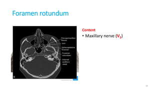 Foramen rotundum
Content
• Maxillary nerve (V2)
39
 