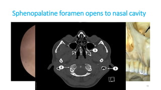 Sphenopalatine foramen opens to nasal cavity
63
 