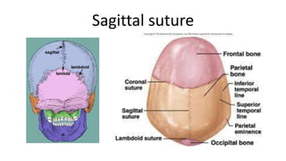 Sagittal suture

 