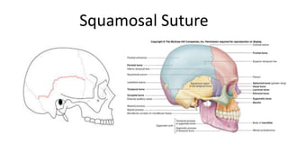 Squamosal Suture

 