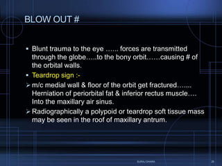 Tear Sign Skull fractures (Regional injury part - 1) | PPTX
