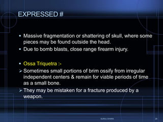 Skull fractures (Regional injury part - 1) | PPTX