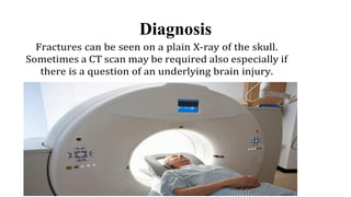 Diagnosis
Fractures can be seen on a plain X-ray of the skull.
Sometimes a CT scan may be required also especially if
there is a question of an underlying brain injury.
 