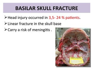 Skull Potential Injuries Comprehensive Overview of Types and Treatments of Head Injuries | PPT
