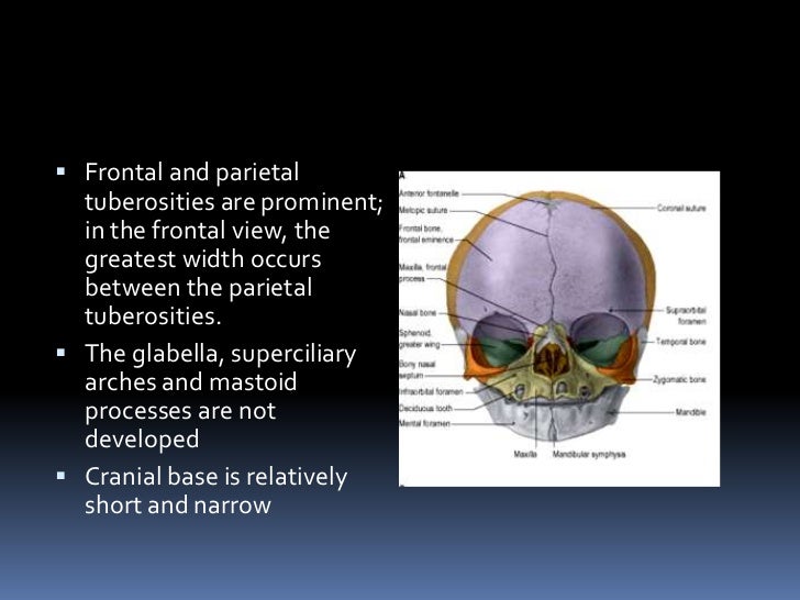 Skull in newborn by DR.ARSHAD