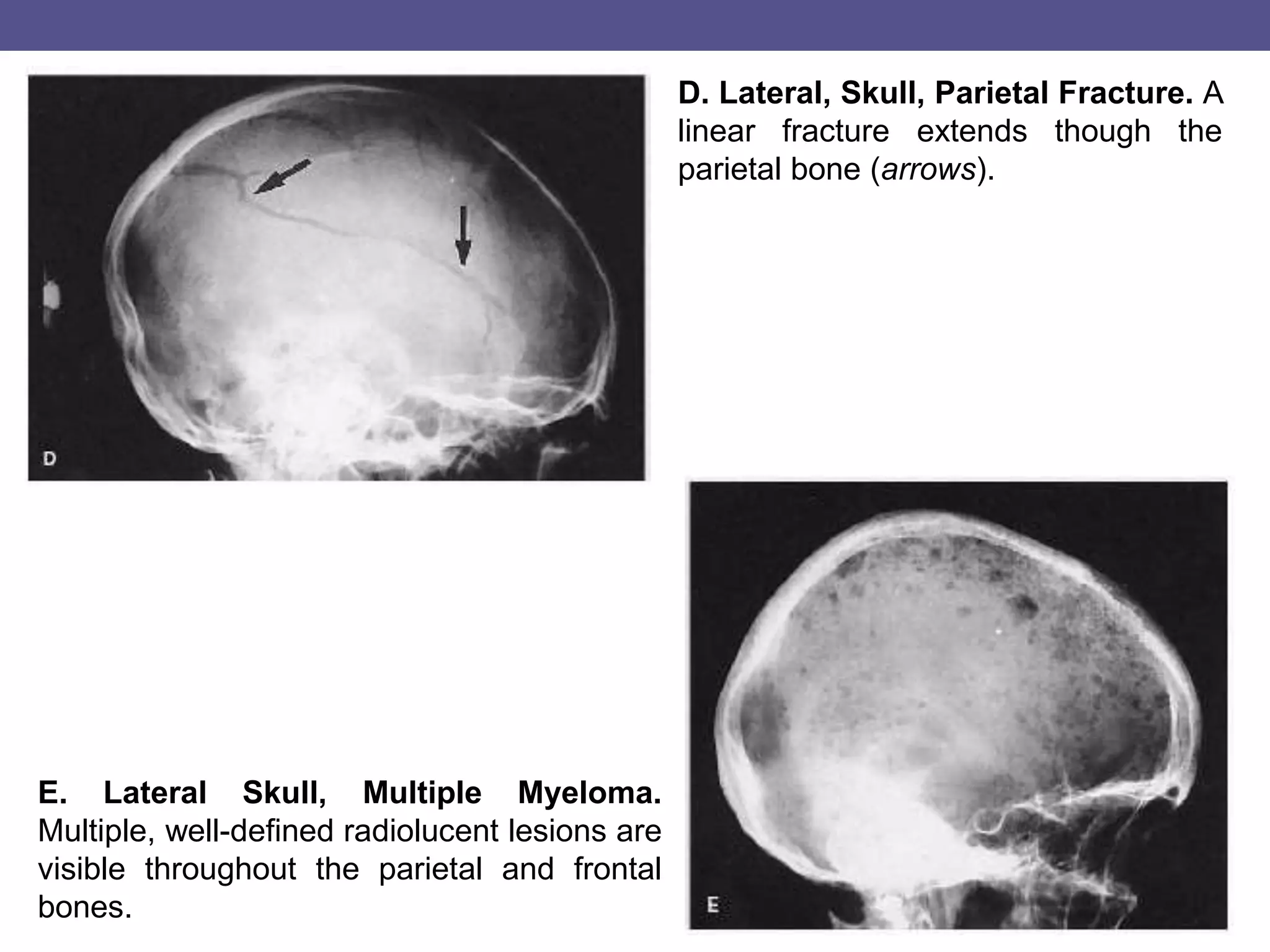 Skull, pns views.pot