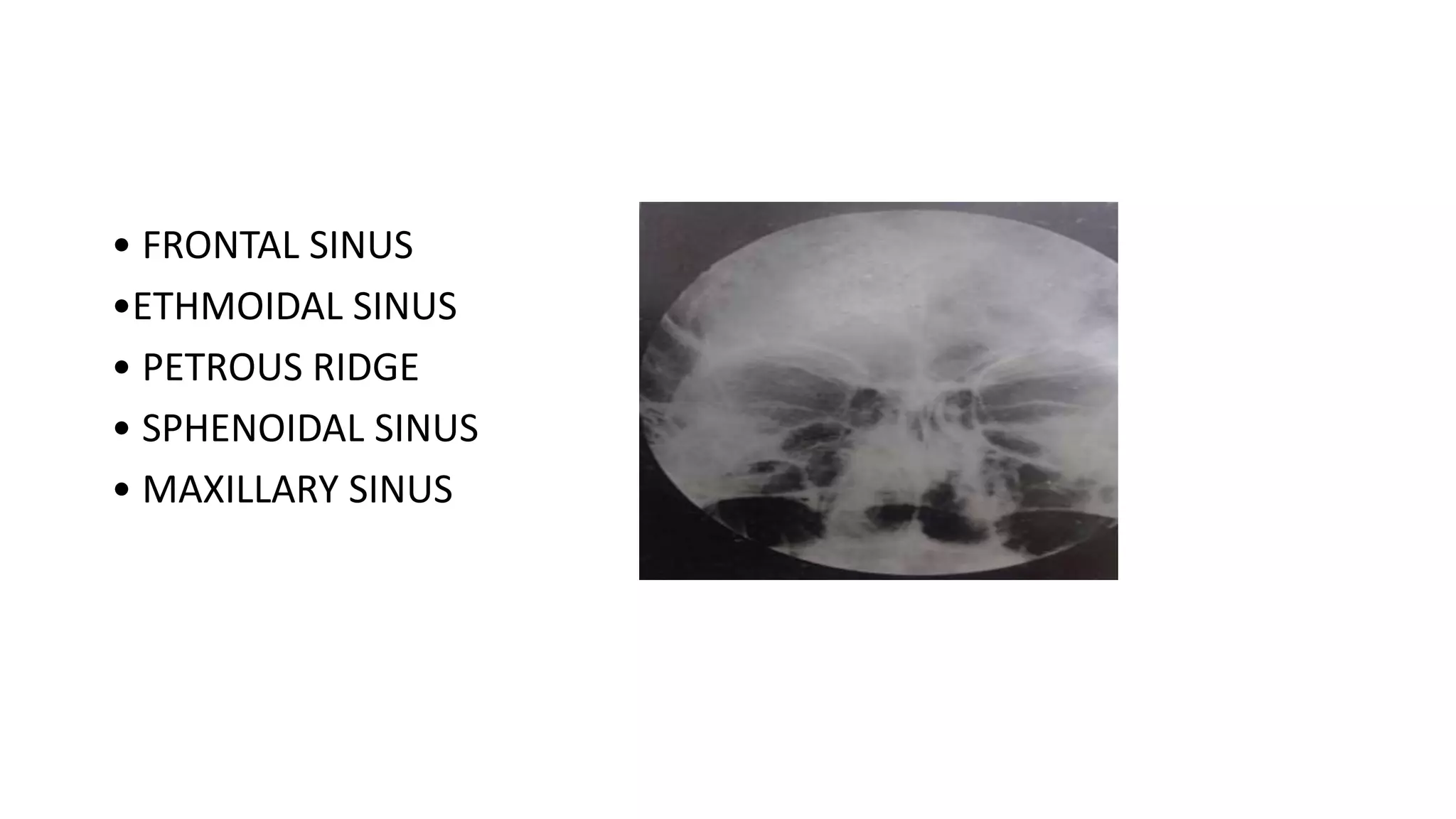Petrous Ridge Positioning Chart Skull positioning by a.s kannan | PPTX