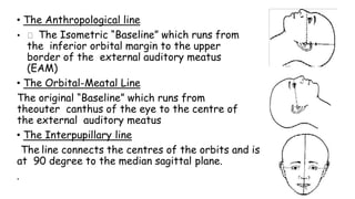 • The Anthropological line
• The Isometric “Baseline” which runs from
the inferior orbital margin to the upper
border of the external auditory meatus
(EAM)
• The Orbital-Meatal Line
The original “Baseline” which runs from
theouter canthus of the eye to the centre of
the external auditory meatus
• The Interpupillary line
The line connects the centres of the orbits and is
at 90 degree to the median sagittal plane.
.
 