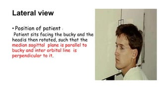 Lateral view
• Position of patient :
Patient sits facing the bucky and the
headis then rotated, such that the
median sagittal plane is parallel to
bucky and inter orbital line is
perpendicular to it.
 
