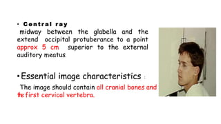 • C e n t r a l r a y
midway between the glabella and the
extend occipital protuberance to a point
approx 5 cm superior to the external
auditory meatus.
• Essential image characteristics :
The image should contain all cranial bones and
thefirst cervical vertebra.
 