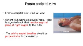 Fronto occipital view
• Fronto occipital view –skull AP view
• Patient lies supine on a bucky table. Head
is adjusted such that median sagittal
plane at right angles to the film.
• The orbito meatal baseline should be
perpendicular to the cassette
 