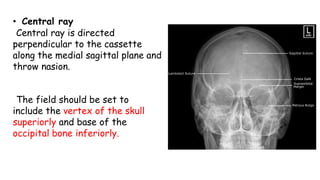 • Central ray
Central ray is directed
perpendicular to the cassette
along the medial sagittal plane and
throw nasion.
The field should be set to
include the vertex of the skull
superiorly and base of the
occipital bone inferiorly.
 