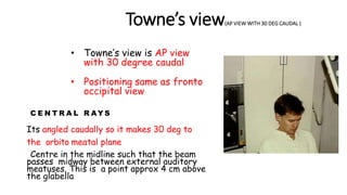 Towne’s view(AP VIEW WITH 30 DEG CAUDAL )
• Towne’s view is AP view
with 30 degree caudal
• Positioning same as fronto
occipital view
C E N T R A L R AY S
Its angled caudally so it makes 30 deg to
the orbito meatal plane
Centre in the midline such that the beam
passes midway between external auditory
meatuses. This is a point approx 4 cm above
the glabella
 