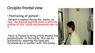 Occipito frontal view
• Positioning of patient :
Patient is seated facing the bucky, so
that the median sagittal plane is with the
midline of the bucky and perpendicular to
it.
Neck is flexed to bring orbito meatal line
perpendicular to the bucky, this can be
achieved by ensuring the nose and
forehead are in contact with the bucky.
 
